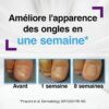 Emtrix Crème et Patchs Mycose Ongle Traitement Clinique-2