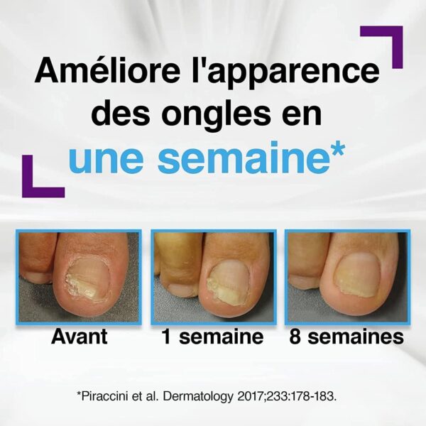 Emtrix Crème et Patchs Mycose Ongle Traitement Clinique-2