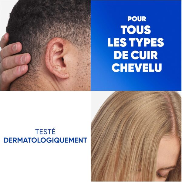 Shampoing antipelliculaire Head Shoulders cheveux gras usage-6