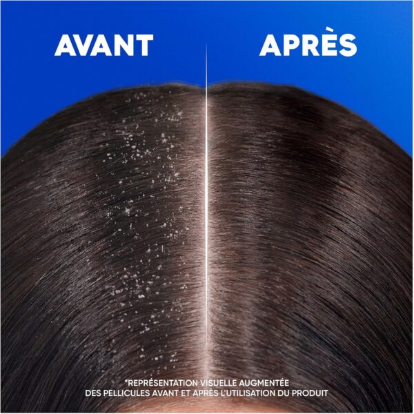 Shampoing antipelliculaire Head Shoulders 2 en 1 usage-4