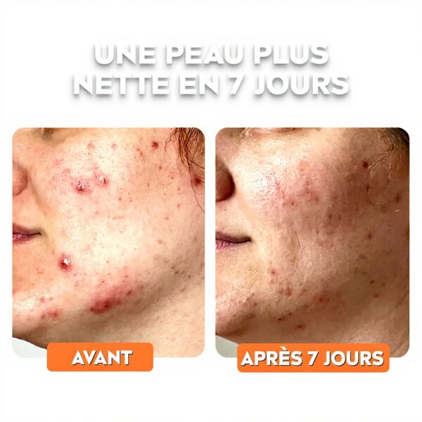 Gel nettoyant visage NIVEA Derma Skin Clear imperfections