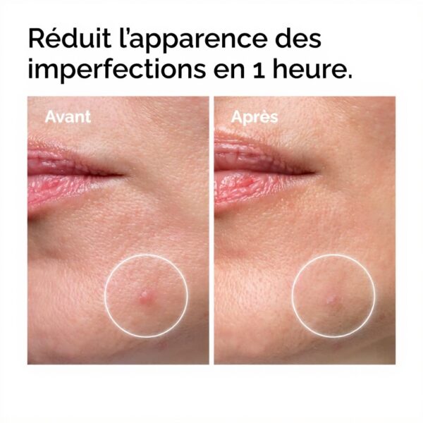 Crème Soufre 10 The Ordinary Traitement Imperfections Peau