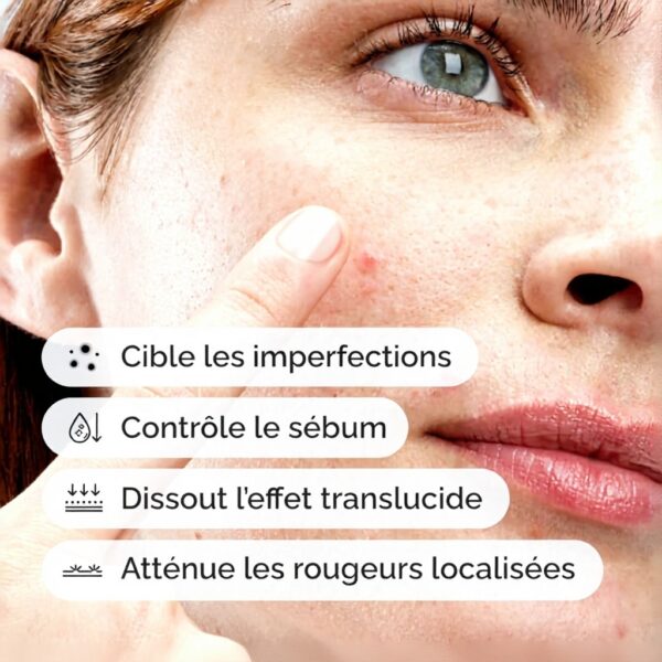 Crème Soufre 10 The Ordinary Traitement Imperfections Peau