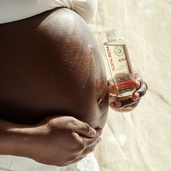 Huile vergetures Topicrem CICA+ cicatrices peaux sensibles-5